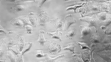 Image of cancer cells