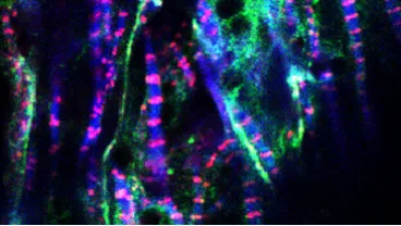 Image of cardiac muscle cells