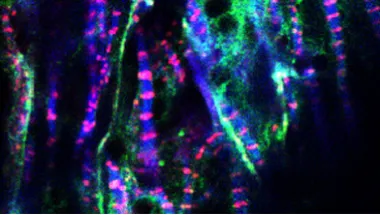 Image of cardiac muscle cells