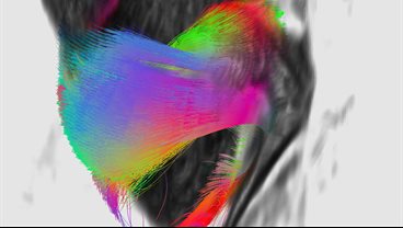 Cardiovascular Imaging