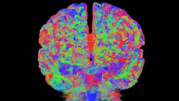 Perinatal Imaging & Health