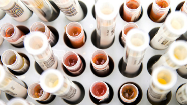 Introduction to Cardiovascular Research
