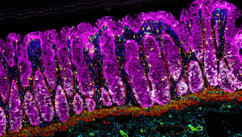 Ciccarelli Laboratory | Cancer Systems Biology Laboratory