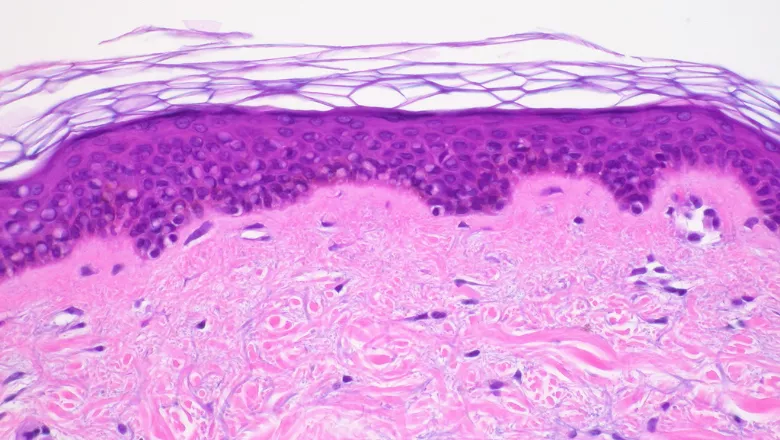 A cross section of skin tissue