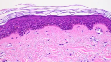 Skin tissue thumbnail (780 × 440 px)