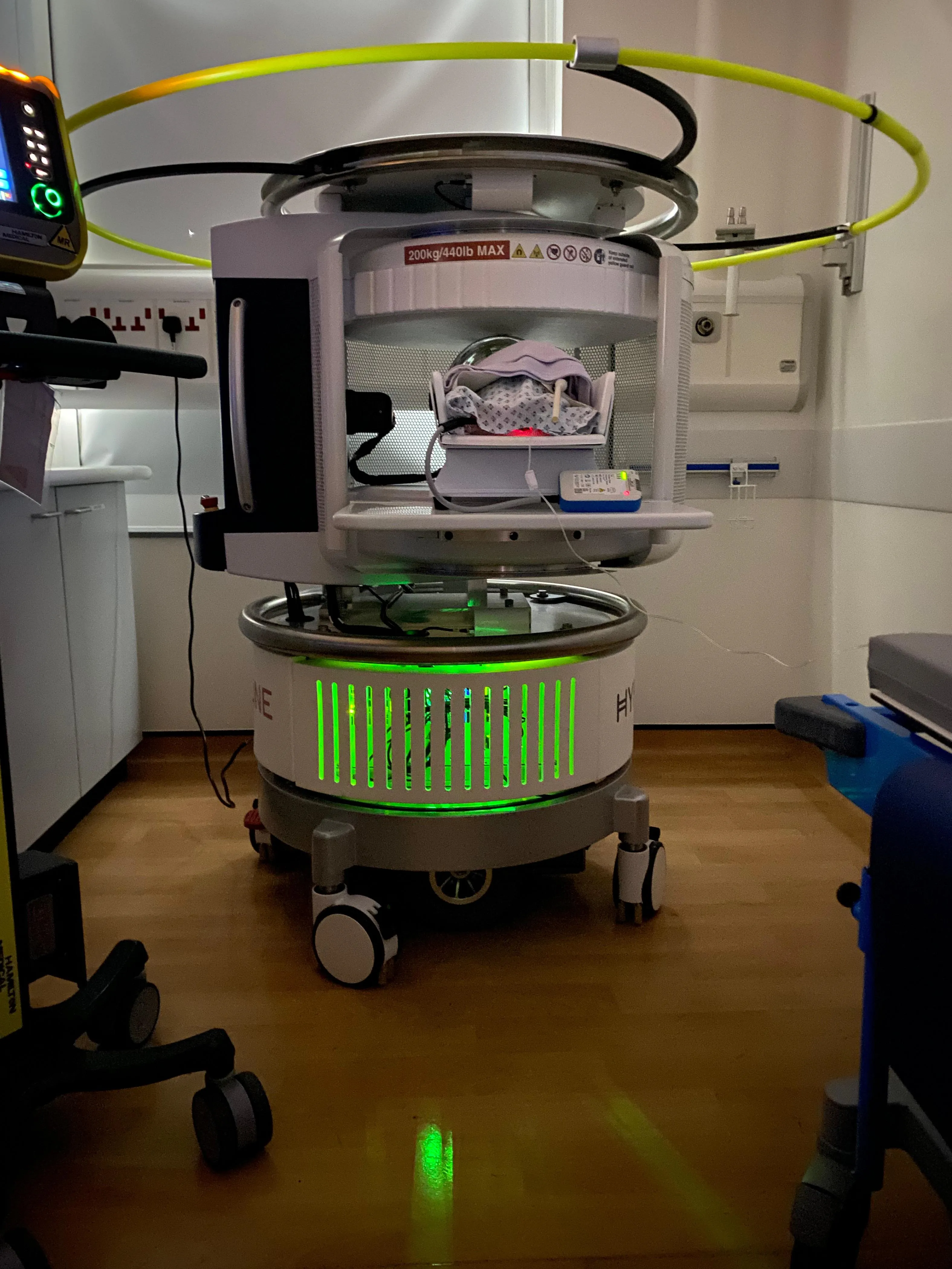 Portable MRI scanners (as pictured) could be used to test babies at their cot-side