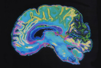 image-of-brain