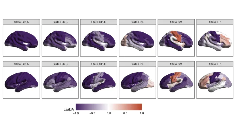 Six transient states brain connectivity identified in the study