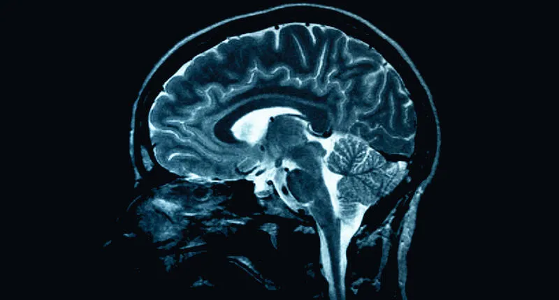 Brain scan