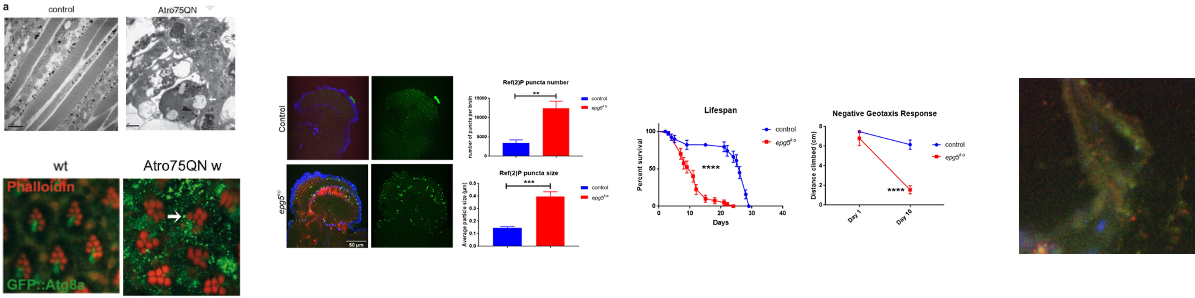 Autophagy images