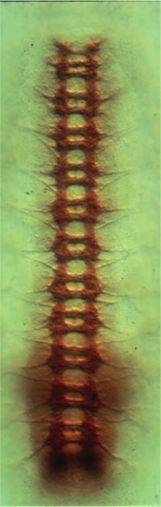 Embryo CNS