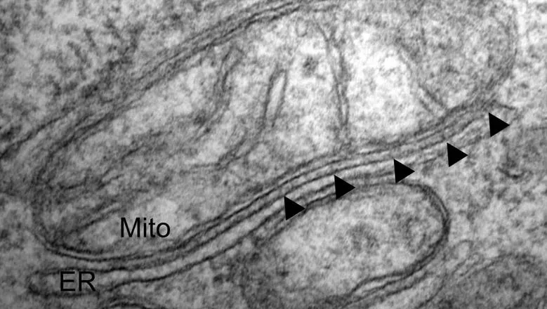 Chris Miller ER-mitochondria MRC Grant