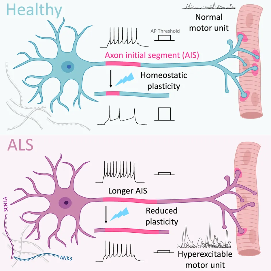 Graphical representation of the role of AIS in ALS pathology
