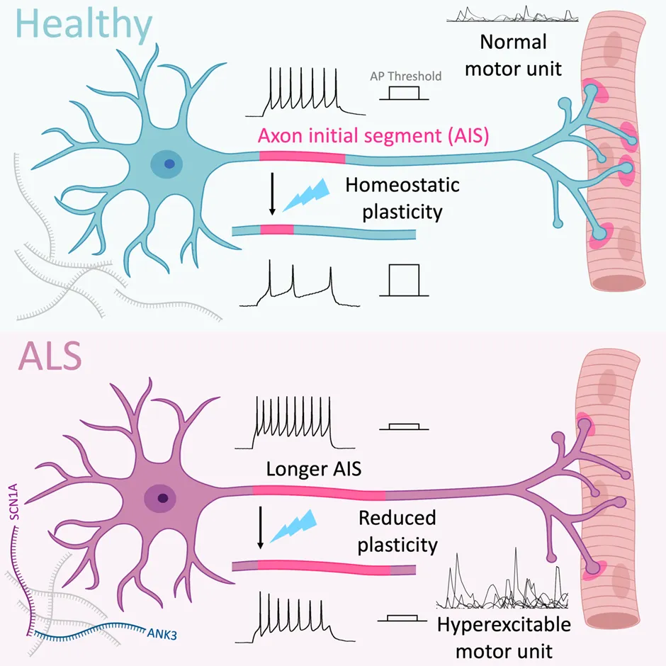 Graphical representation of the role of AIS in ALS pathology