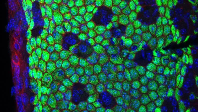 Limited use View of stria vascularis of Spns2 mutant at 8 weeks old