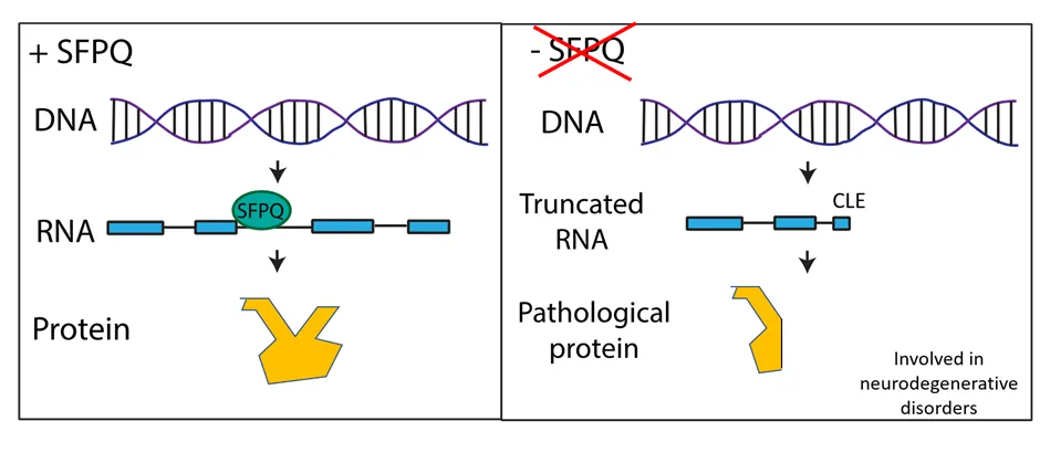 In normal brain cells, SFPQ protects from integrating a ‘wrong’ sequence in a series of RNAs coding for important neuronal proteins. RIGHT panel: In brain cells lacking SFPQ and in ALS neurons, a series of RNA integrate a ‘wrong’ sequence that terminates the RNA too early. These RNAs produce pathogenic proteins. 