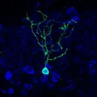 Olfactory bulb dopaminergic neuron