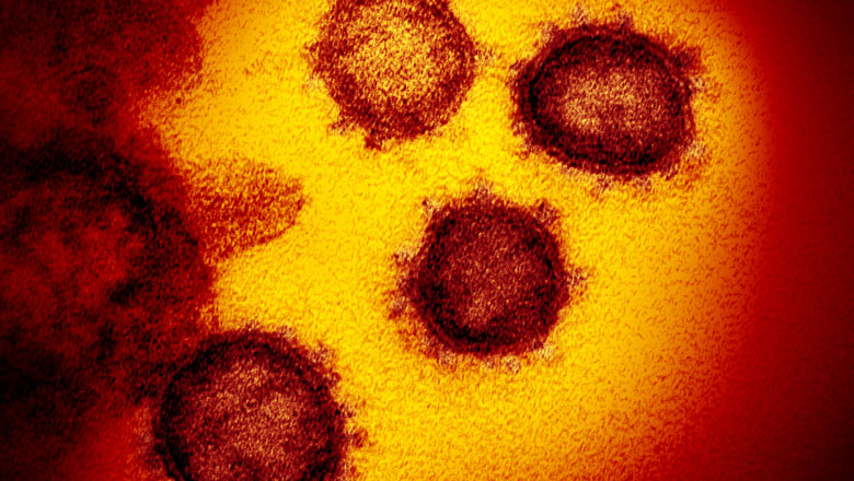Red and yellow visualisation of the novel coronavirus