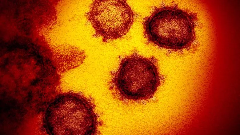 Transmission electron micrograph of SARS-CoV-2 virus particles captured by NIAID.
