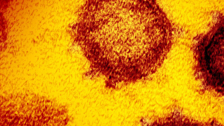 Red and yellow visualisation of the novel coronavirus