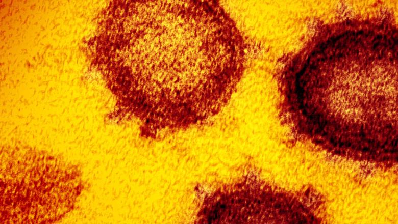 Red and yellow visualisation of the novel coronavirus