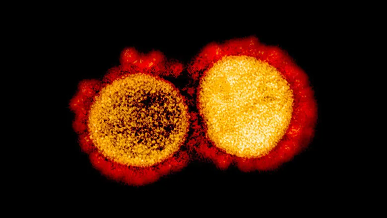 Image of coronavirus particles