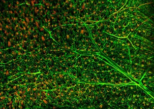 stem cells