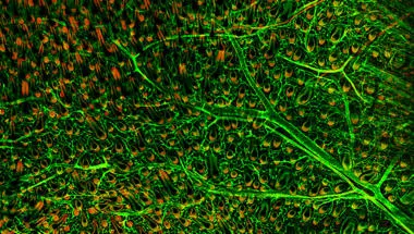 stem cells