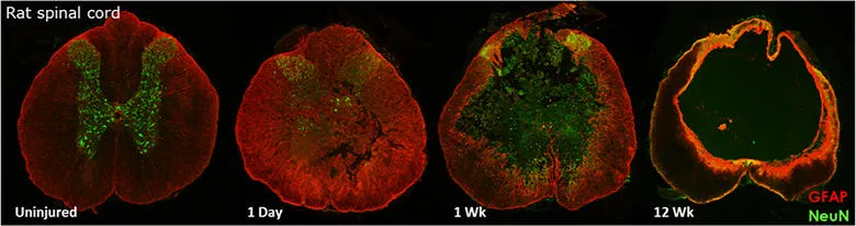 Composite image showing neural activity in rat spinal cord following gene therapy