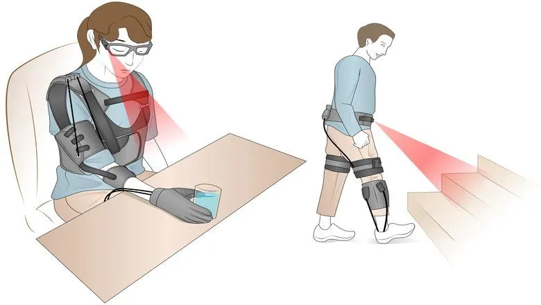 prosthetics machine vision