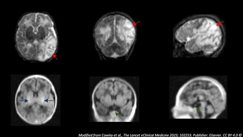 Portable MRI scan imagery