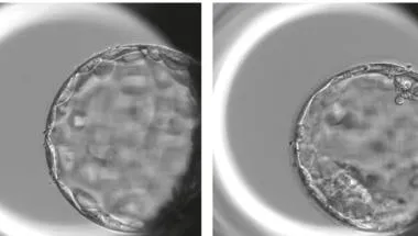 human embryo brightfield