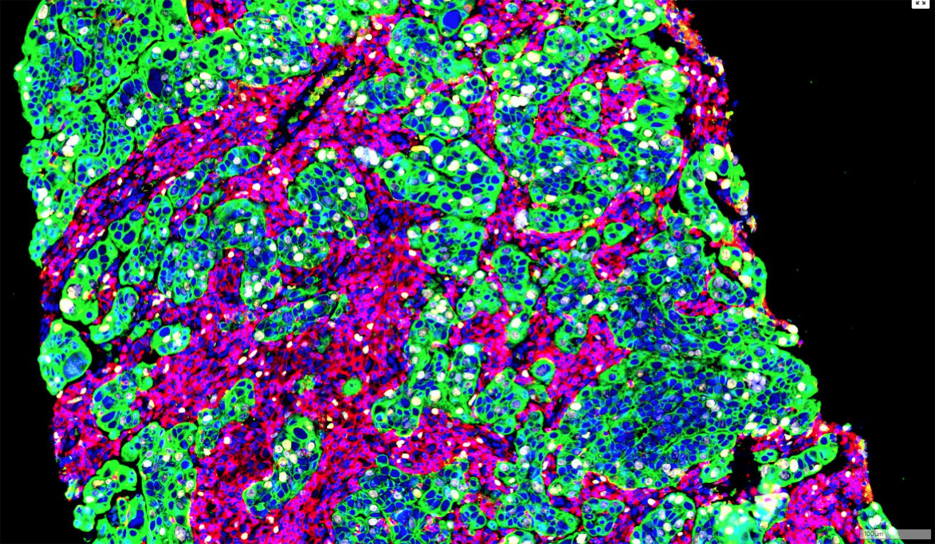 spatial transcriptomics
