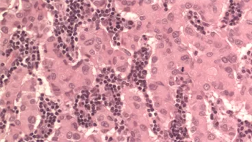 Translational Pathology