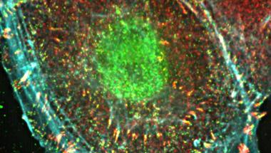 iSIM imaging of cell adhesion structures