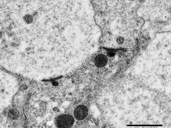 CUI Image - (Inner hair cell ribbon synapses in cochlear tissue)