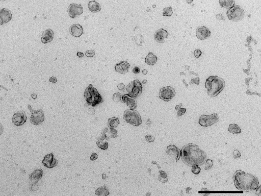 CUI Image - negatively stained exosomes