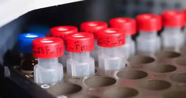 Red Sample bottles 