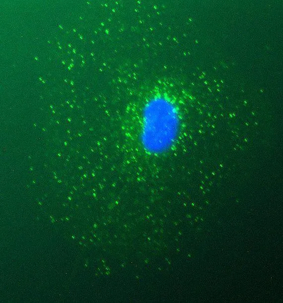 Jimenez Sanchez Autophagy image