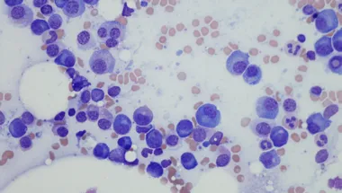 bone marrow cells 780x450