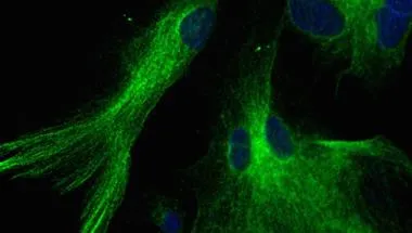 Glial cells and Neurodegeneration