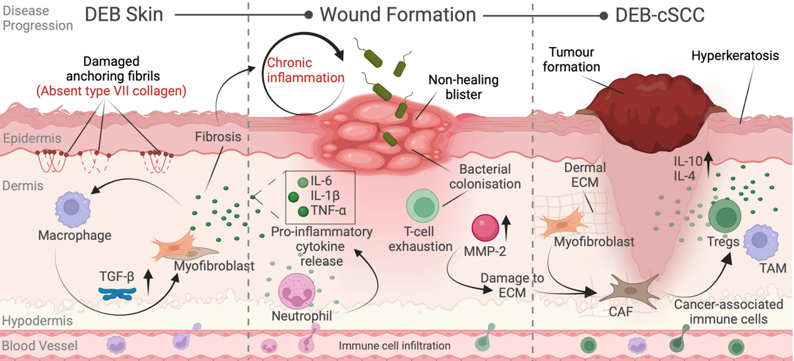 Graphic describing the disease progression of skin