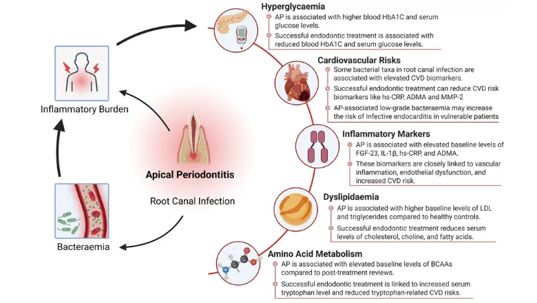Apical Periodontitis as a Non-Communicable Disease and Post-Endodontic Healing