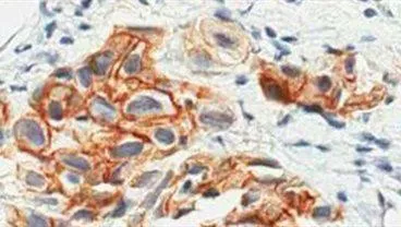 Experimental Oncology