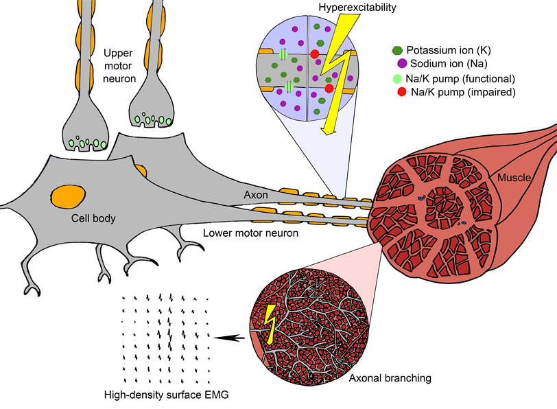 Fasciculation schematic