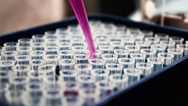 pipette and test tubes in a laboratory