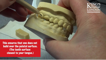 Tooth Waxing Demonstration