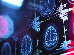 Clinical Neuroscience and Forensic mental health