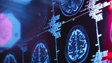 Clinical Neuroscience and Forensic mental health