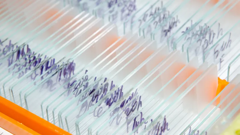 Washing away plastic waste in cancer research